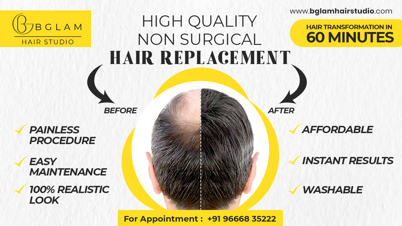 Hair Replacement in Hyderabad