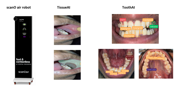 TissueAI to Help India Fight Oral Cancer – Built and Launched by scanO AI