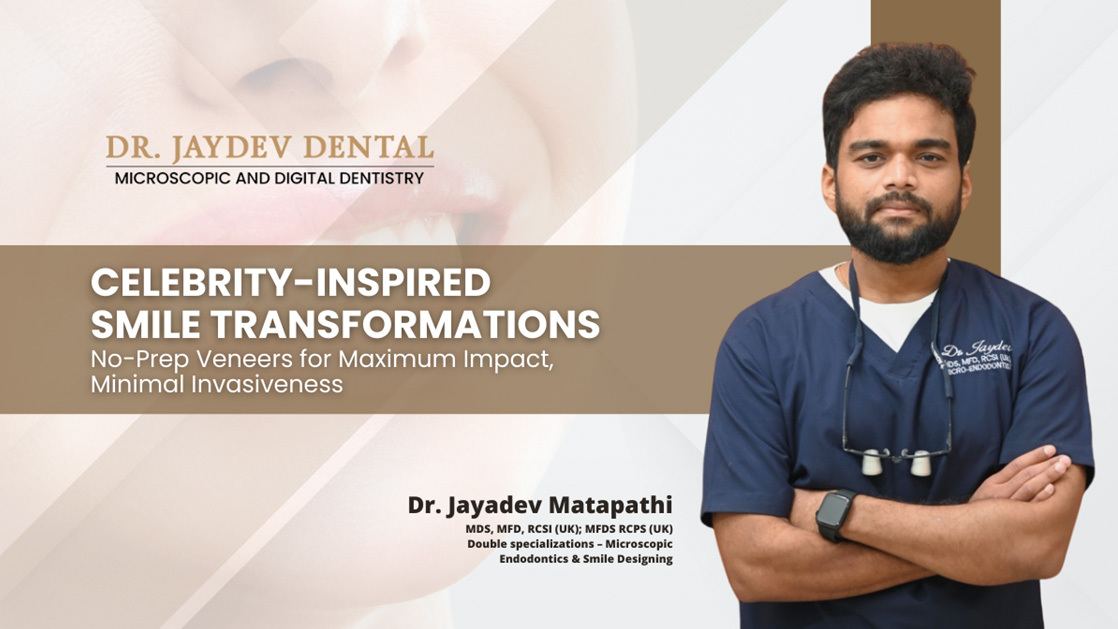 Minimal Invasiveness Meets Maximum Results: The Rise of No-Prep Veneers, Inspired by Celebrities' Smile Transformations