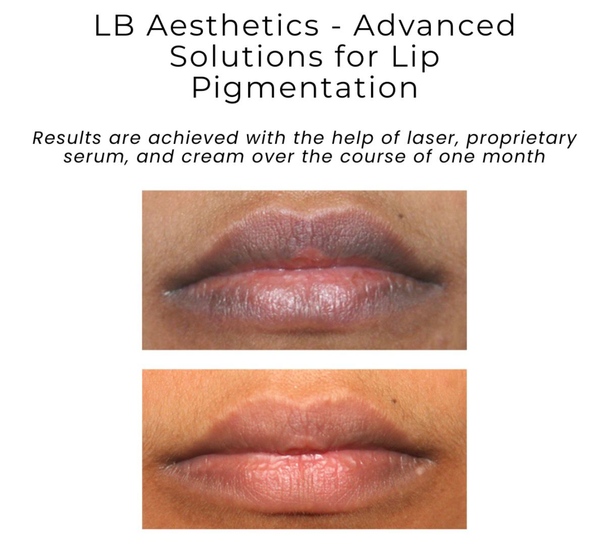 LB Aesthetics Offers Trusted Lip Pigmentation Treatments in Delhi