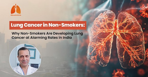 Lung Cancer in Non-Smokers: Why Non-Smokers Are Developing Lung Cancer at Alarming Rates in India