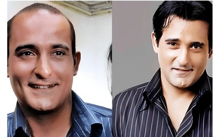 The Secret Behind Bollywood’s Perfect Hair? Why Hair Patches Are Becoming the Go-To Solution